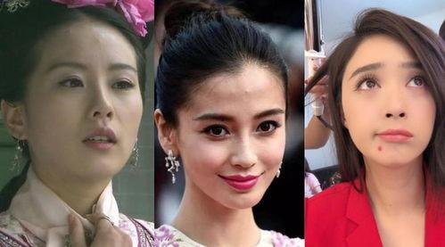 女明星不长痘,揭秘女明星不长痘的护肤秘诀